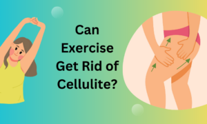 Can Exercise Get Rid of Cellulite