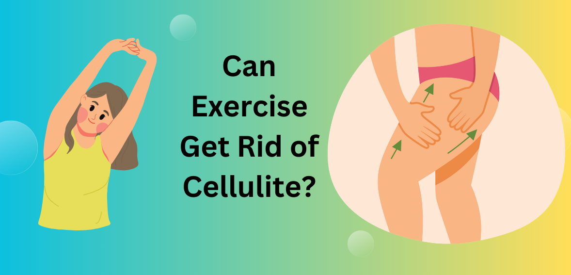 Can Exercise Get Rid of Cellulite