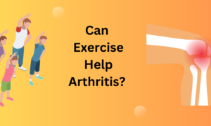 Can Exercise Help Arthritis