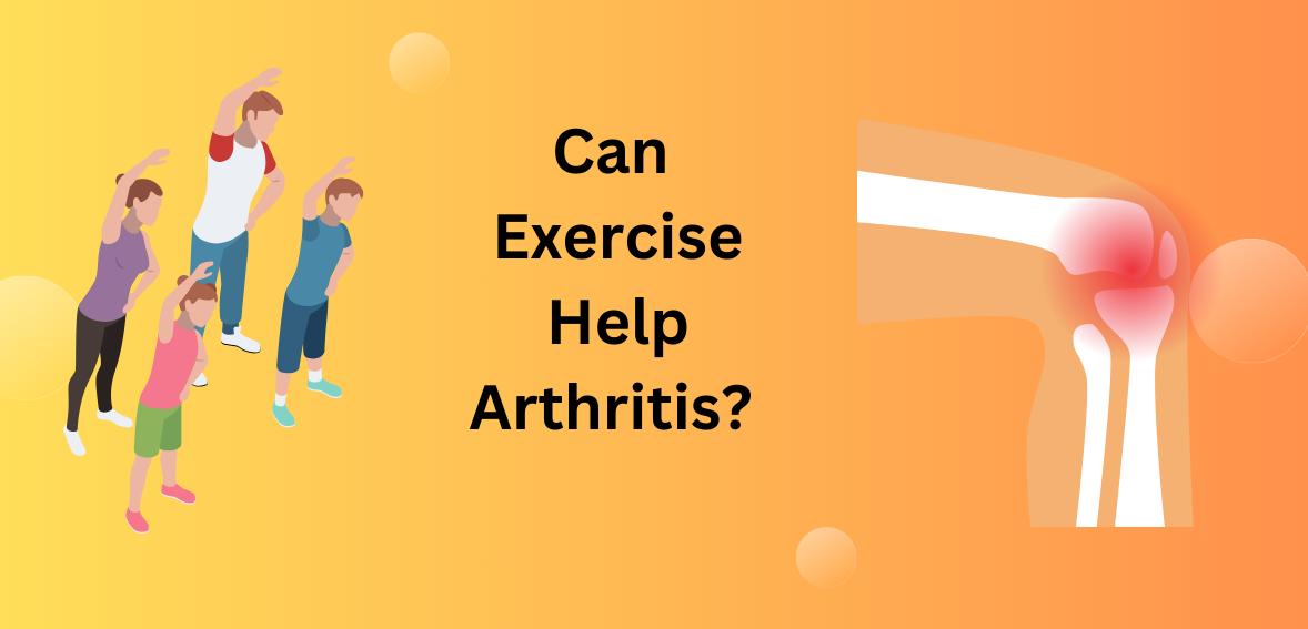 Can Exercise Help Arthritis