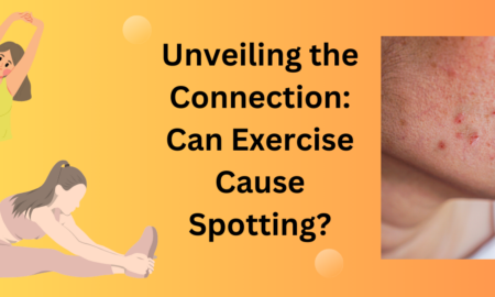 can exercise cause spotting