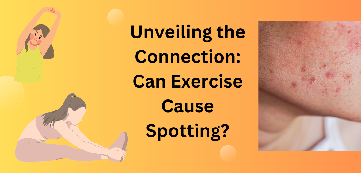 can exercise cause spotting